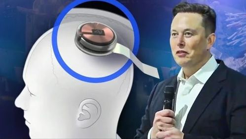 **马斯克旗下Neuralink启动首例人体脑机接口实验**